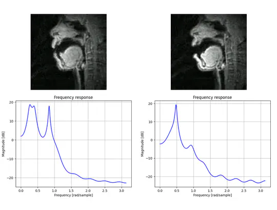 Vocal Tract MRI to Speech